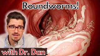 Roundworms in the Dog [upl. by Ellennad]