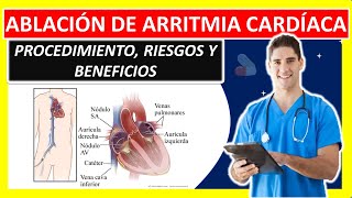 ABLACION CARDIACA POR ARRITMIA [upl. by Ayhtnic]