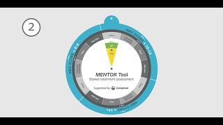 MENTOR Tool [upl. by Averi]