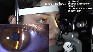 Ophthalmic Skills Series Part 15 [upl. by Bathulda81]