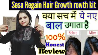 SESA regain 2 step hair growth kithair oil reviewSESA hair oil [upl. by Devine182]