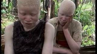 Deadly Hunt Albinos in Tanzania [upl. by Carlynn]