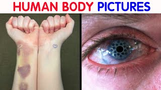 “My Eye Is Gradually Losing Its Color” 50 Interesting Human Body Pics [upl. by Schofield]