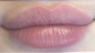 Heart shaped kisses ♡ lip filler procedure lip lift pink rosy color 💉 [upl. by Asirralc672]