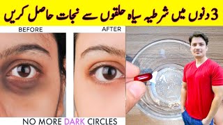 How To Remove Dark Circles Naturally in 3 Days By ijaz Ansari  Dark Circles Homemade Removal Cream [upl. by Nodnrb]