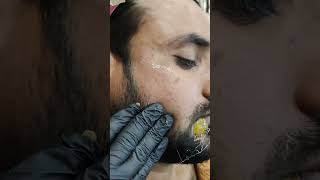 Hair Removal Waxing For Face skincare adi viral youtube [upl. by Nosidam]