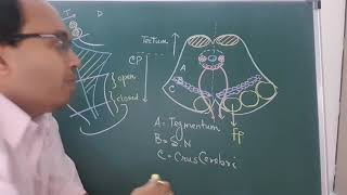 Midbrain sections  superior amp inferior colliculii [upl. by Nylinej427]