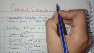 Cervical Spondylosis [upl. by Ethelda591]