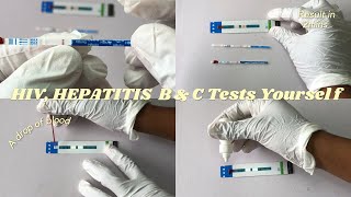 HOW TO DO HIV HEPATITIS B amp HEPATITIS C Tests Yoursef [upl. by Kwasi679]