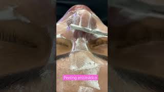 Peeling enzimático com técnica de espatulação [upl. by Atneuqal]