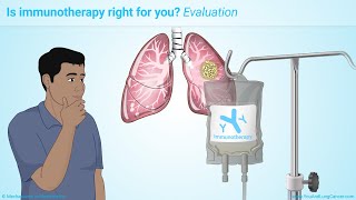 Immunotherapy Treatments for NonSmall Cell Lung Cancer NSCLC [upl. by Lexy]