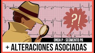 Paso 5 y 6 El secreto para evaluar la ONDA P Y SEGMENTO PR Fácil y SENCILLO  Dr JR [upl. by Piane]