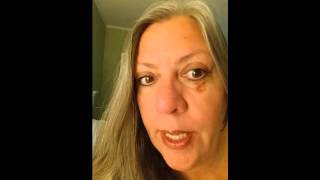 Upper Blepharoplasty Eyelid Surgery Recovery Day 11 [upl. by Rudich]