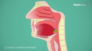 Dysphagie troubles de la déglutition et Fausse route questce que cest [upl. by Bord487]