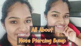 All About Nose Piercing Bump  Explained  Malayalam [upl. by Melena]