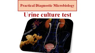 Urine culture test  micro lab 2 [upl. by Myrwyn]