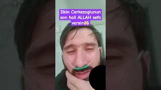 Ilkin Cerkezoglu ALLAH sefa versin tiktokvideo whatsappstatus instagramstatus sonxeber [upl. by Yale]