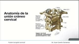 Fusión occipito cervical [upl. by Shelman]