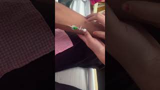 IV cannula insertiontrendingforyousongshortvideoviralvideo [upl. by Ettezus]