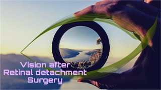 12 How Is VISION after retinal detachment surgery  RETINAL DETACHMENT retinaldetachment [upl. by Nner]