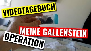 Videotagebuch zur Operation meiner Gallensteine [upl. by Eniad]