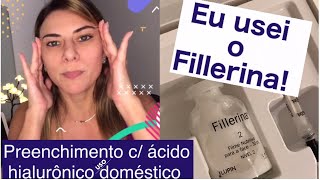 FILLERINA cÁcido Hialurônico pPreenchimento Rugas e Depressões CutâneasAqui todos detalhes [upl. by Wise458]